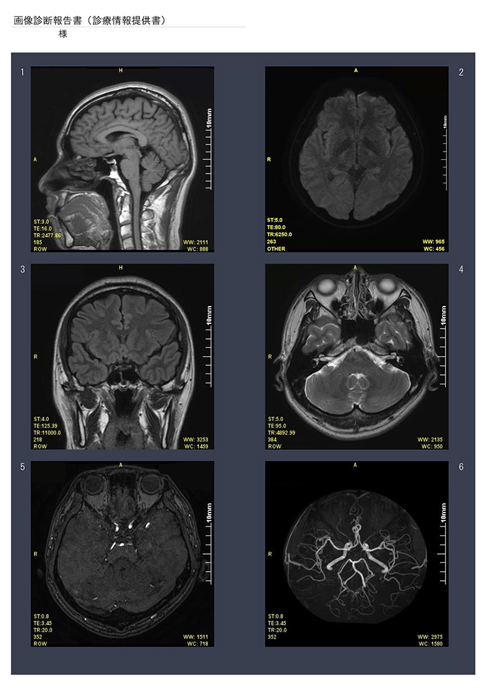 画像診断報告書　参照画像の添付