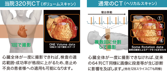 撮影方法の違い