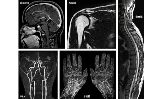 検査 費用 mri