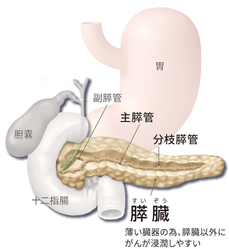 図は分枝型IPMNの診療アルゴリズム2017