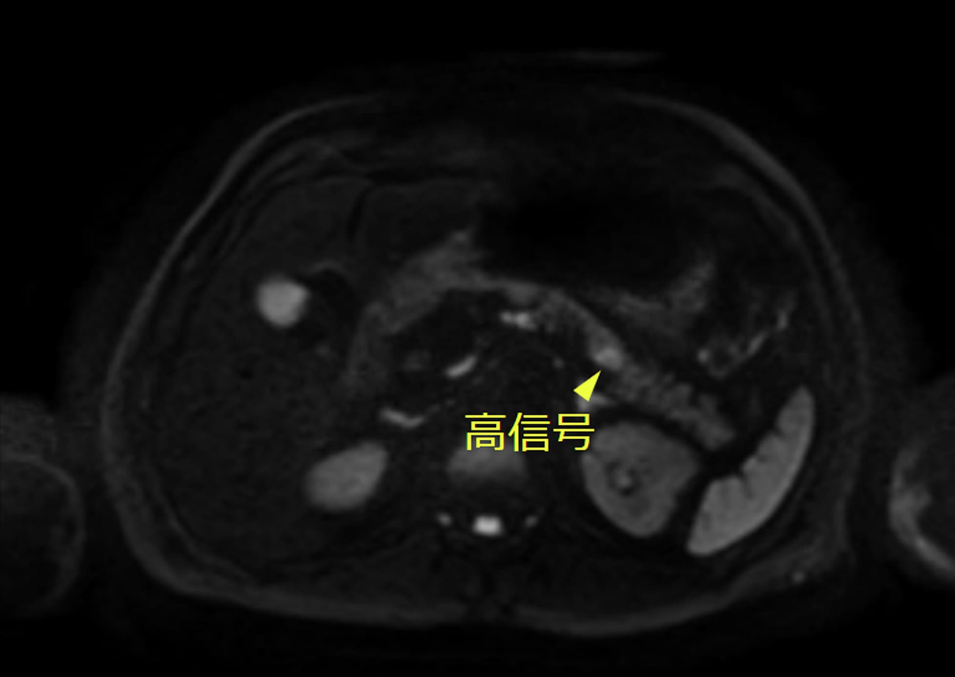 年代別死亡原因